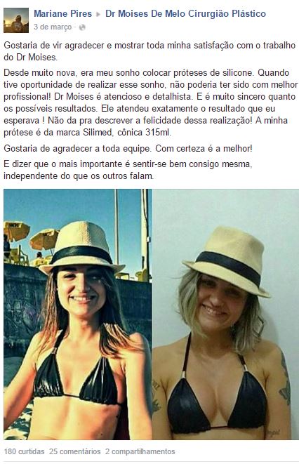 Mariane Pires depoimento cirurgia plastica