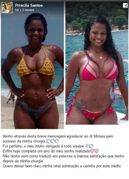 Priscila Santos depoimento cirurgia plastica