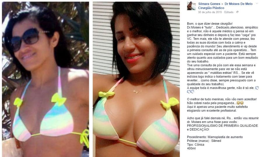 Silmara Gomes‎ depoimento cirurgia plastica