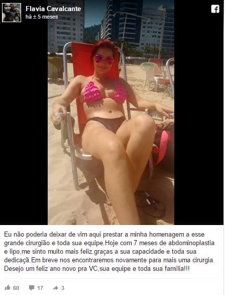 ‎Flavia Cavalcante depoimento cirurgia plastica