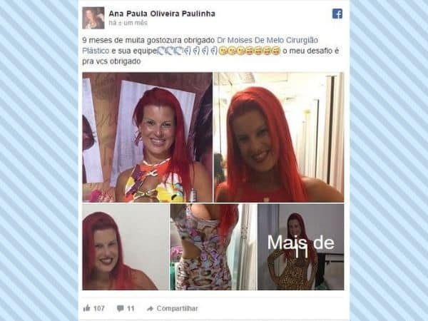 Ana Paula Oliveira Paulinha depoimento cirurgia plastica