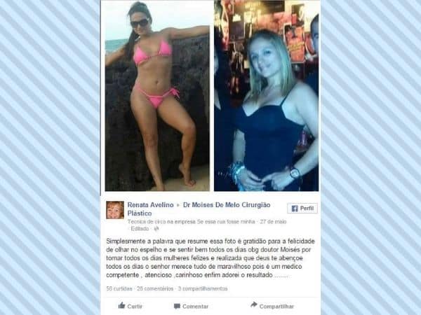 Depoimento sobre cirurgia plastica Renata Avelino