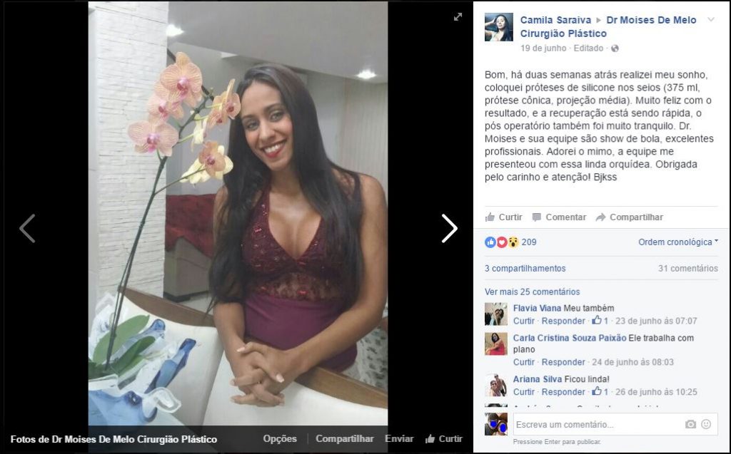 Depoimento sobre cirurgia plástica por Camila Saraiva