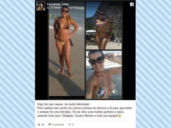 Fernanda-Teles-depoimento-cirurgia-plastica 2