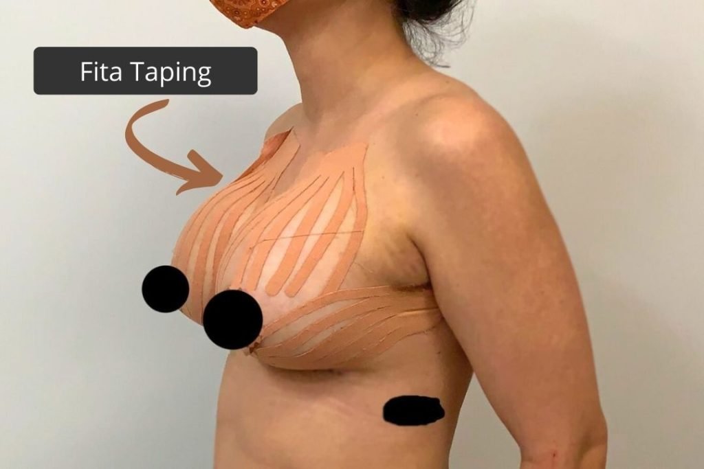 Fita Taping cirurgia plástica