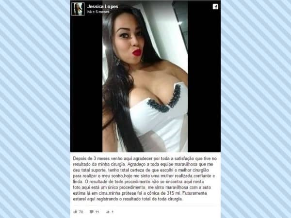 Jessica Lopes depoimento cirurgia plastica