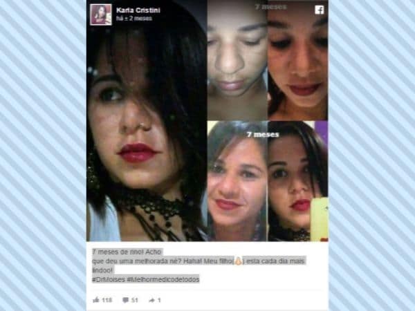 Karla Cristini depoimento cirurgia plastica