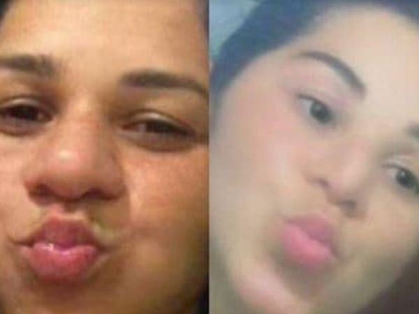 Karla Cristini depoimento cirurgia plastica