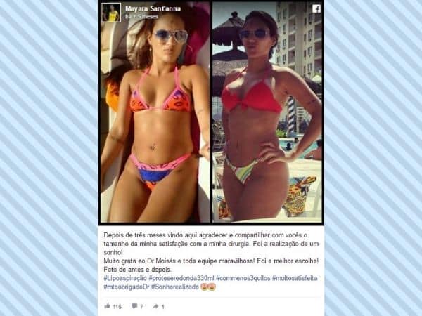 Mayara Santanna depoimento cirurgia plastica
