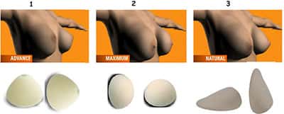 Modelos de prótese de silicone: (1) cônica (2) redonda (3) em gota
