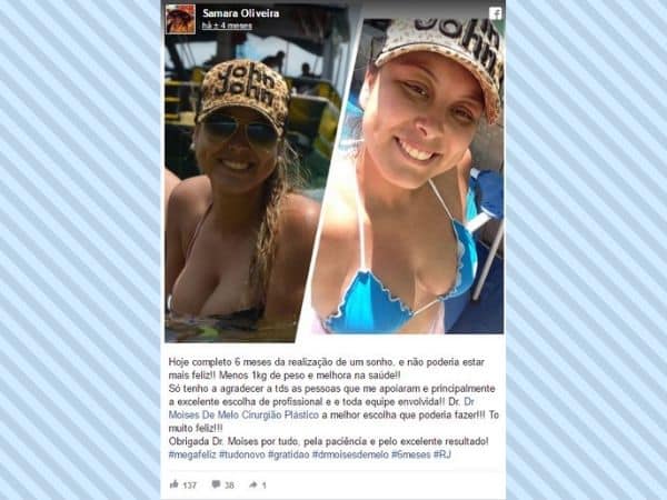 Samara Oliveira depoimento cirurgia plastica