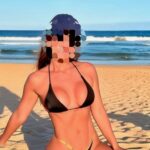 Resultado de lipoaspiração de alta definição com o Dr. Moises de Melo
